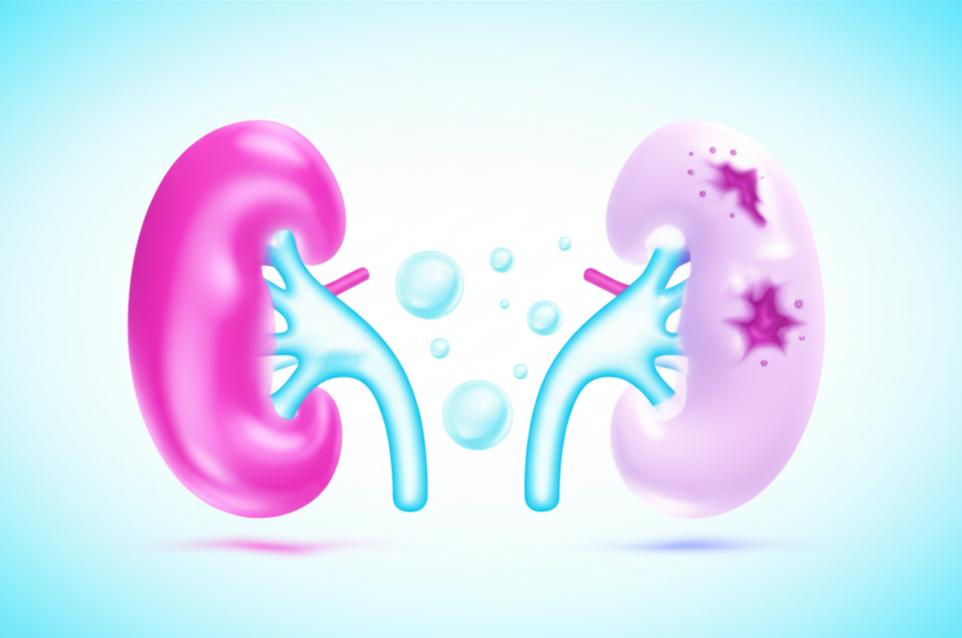 หยุดทำสิ่งนี้ทันที! 5 พฤติกรรมที่คุณทำแล้ว ‘ไต’ พังเร็วขึ้น เสี่ยง ‘ฟอกไต’ ก่อนวัยอันควร section 1