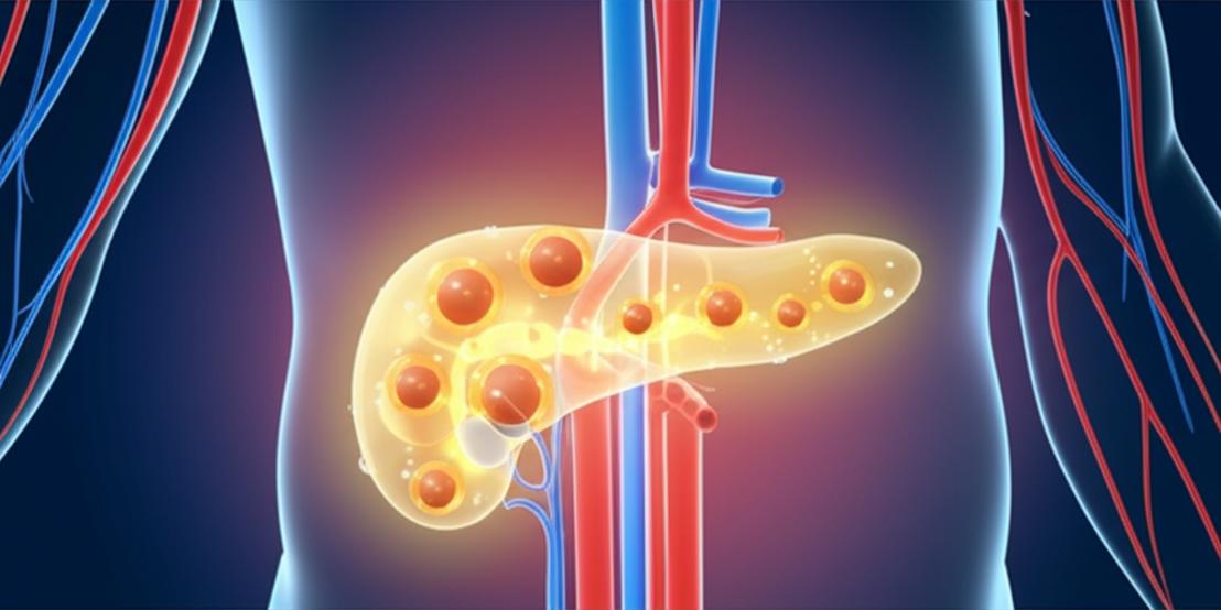 แนวทางโภชนาการเพื่อการควบคุมสมดุลน้ำตาลในเลือด: กินอย่างไรให้สุขภาพดีและไม่รู้สึกขาด section 1