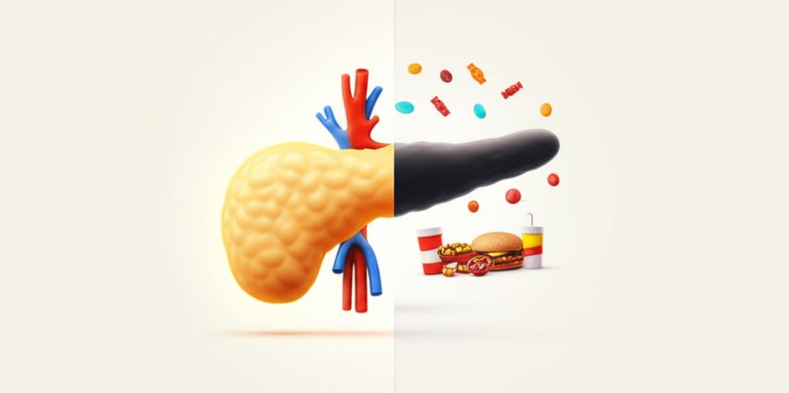 วิธีคุมน้ำตาลแบบ 